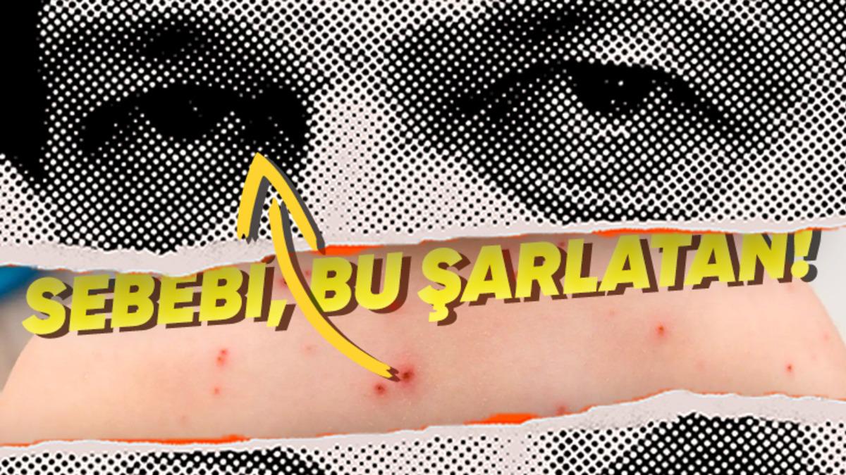 Türkiye’yi Alarma Geçiren Kızamık Salgınının Yeniden Hortlamasına Neden Olan Rahatsız Edici Gerçekler