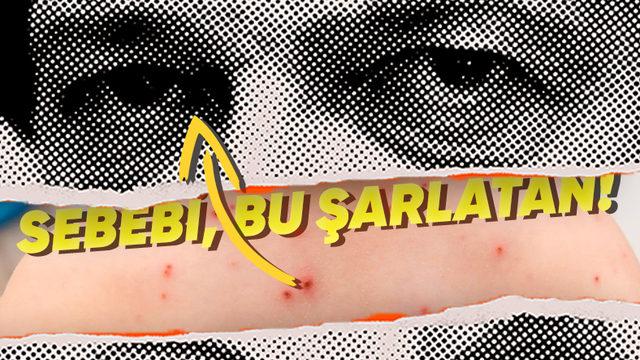 Türkiye’yi Alarma Geçiren Kızamık Salgınının Yeniden Hortlamasına Neden Olan Rahatsız Edici Gerçekler