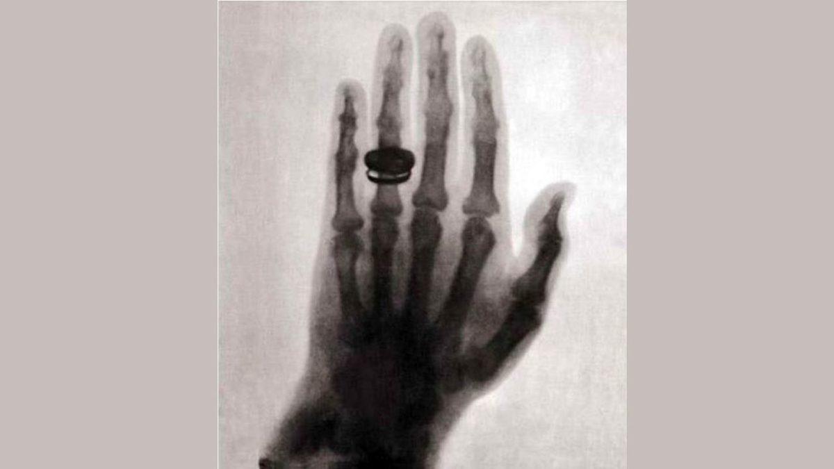 Türkiye’ye X Işınını Getiren Ancak Henüz 28 Yaşındayken Hayatını Kaybeden Öncü Doktorun İlham Veren Öyküsü