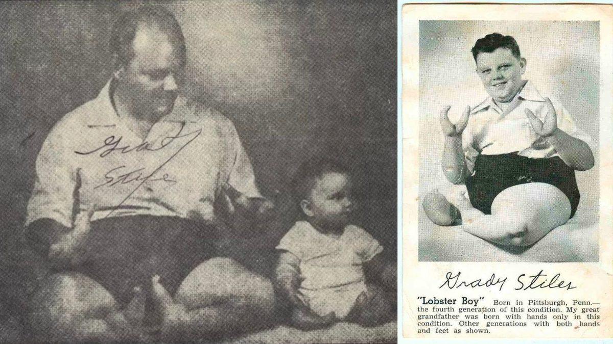 Istakoz Kıskacına Benzer Elleri Olan Grady Stiles’ın Bir Katil Tarafından Sonlandırılan Tuhaf Öyküsü