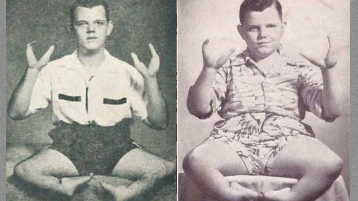 Istakoz Kıskacına Benzer Elleri Olan Grady Stiles’ın Bir Katil Tarafından Sonlandırılan Tuhaf Öyküsü