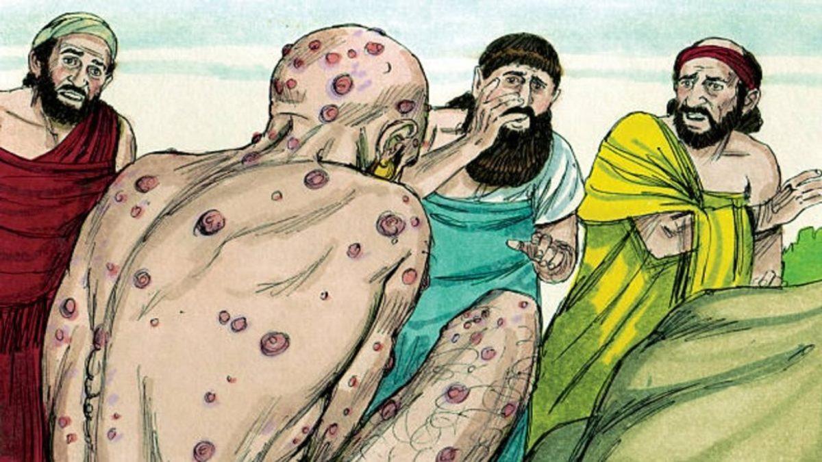 İnsanlık Dışı Yöntemlerle Pek Çok Kişinin Ölüme Terk Edildiği Rahatsızlık Cüzzamın Tarihte Neden Olduğu Karmaşalar