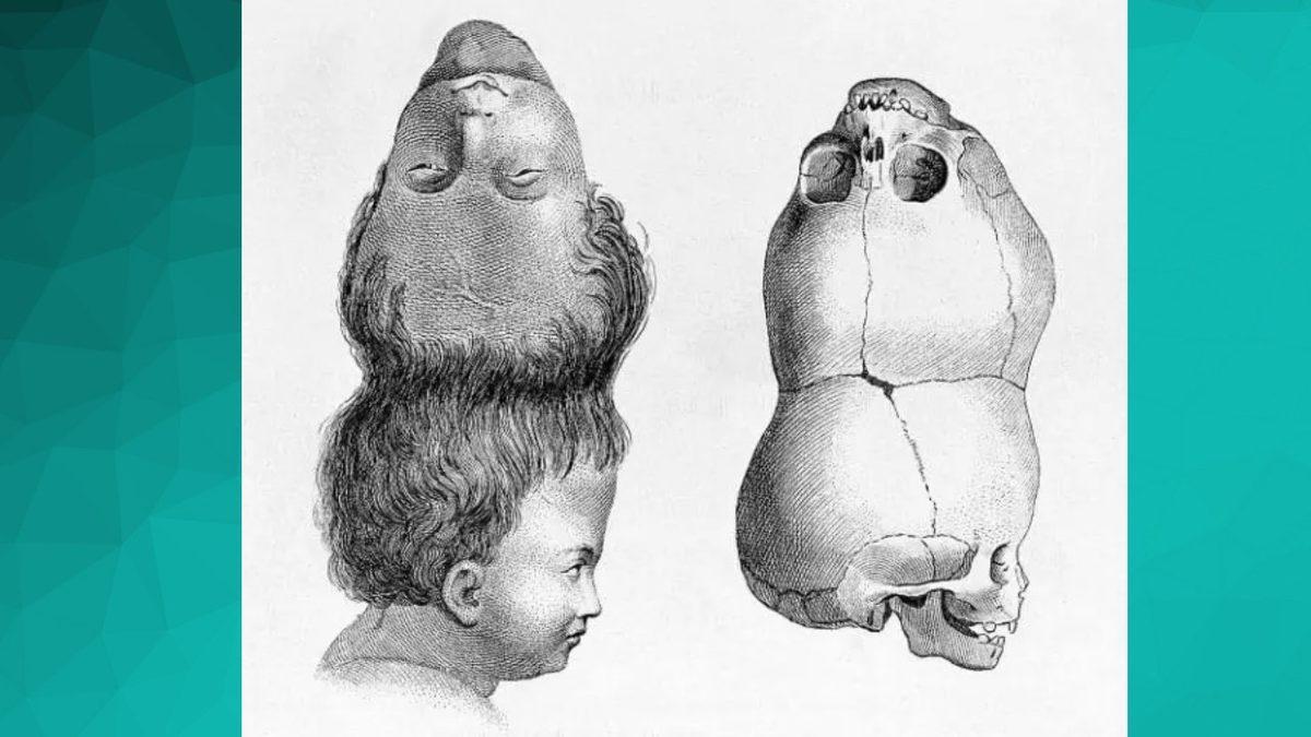 İki Başla Doğan Bebeklere Dair İnanması Güç Detaylar: Bir Örneği Var ki Şimdiye Kadar Görüp Duyduklarınızı Adeta Sollar Nitelikte!