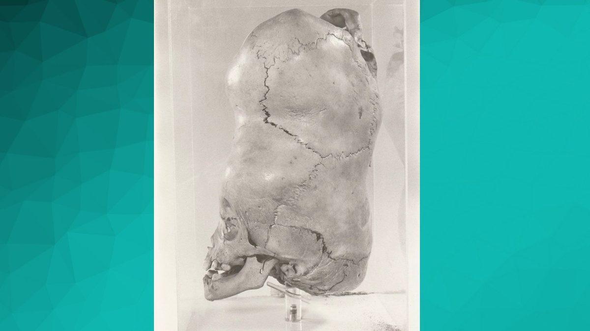 İki Başla Doğan Bebeklere Dair İnanması Güç Detaylar: Bir Örneği Var ki Şimdiye Kadar Görüp Duyduklarınızı Adeta Sollar Nitelikte!