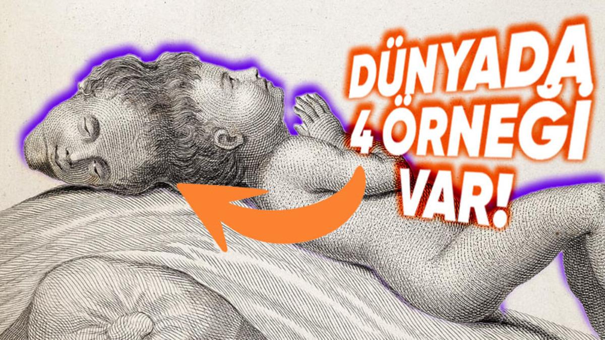 İki Başla Doğan Bebeklere Dair İnanması Güç Detaylar: Bir Örneği Var ki Şimdiye Kadar Görüp Duyduklarınızı Adeta Sollar Nitelikte!