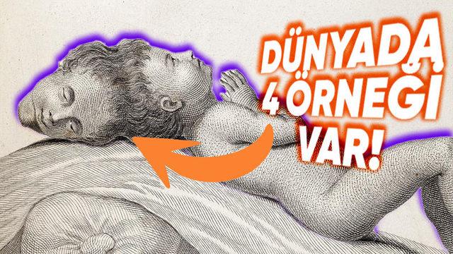 İki Başla Doğan Bebeklere Dair İnanması Güç Detaylar: Bir Örneği Var ki Şimdiye Kadar Görüp Duyduklarınızı Adeta Sollar Nitelikte!