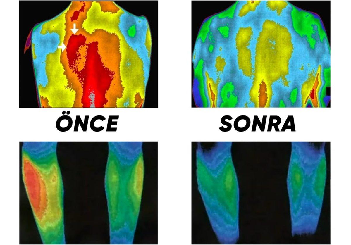Öğrendikten Sonra Kendinizi Dağa, Bayıra Atmak İsteyeceksiniz: İşte Topraklamanın Vücudunuza Olan Saymakla Bitmeyecek Faydaları