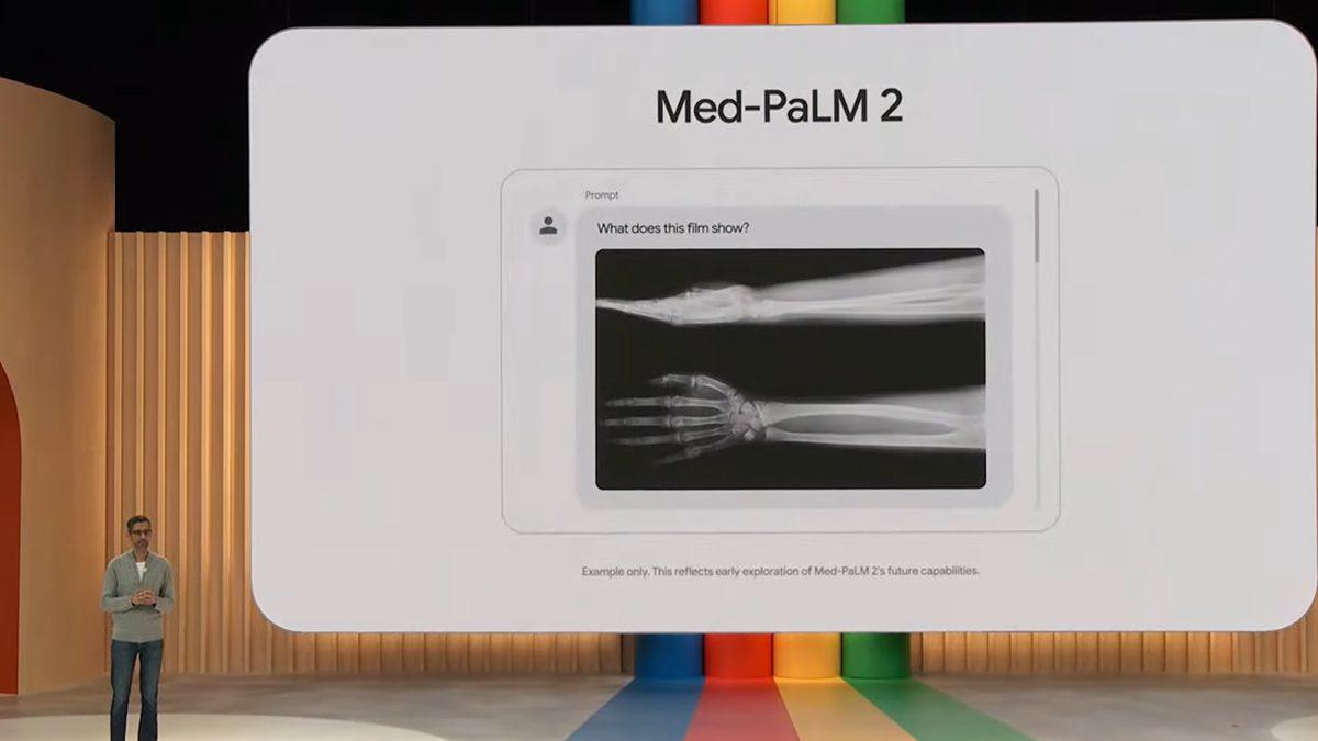 Google’ın Tıbbi Yapay Zeka Aracı, Hastanelerde Test Edilmeye Başlandı: Röntgenleri Bile Yorumluyor!