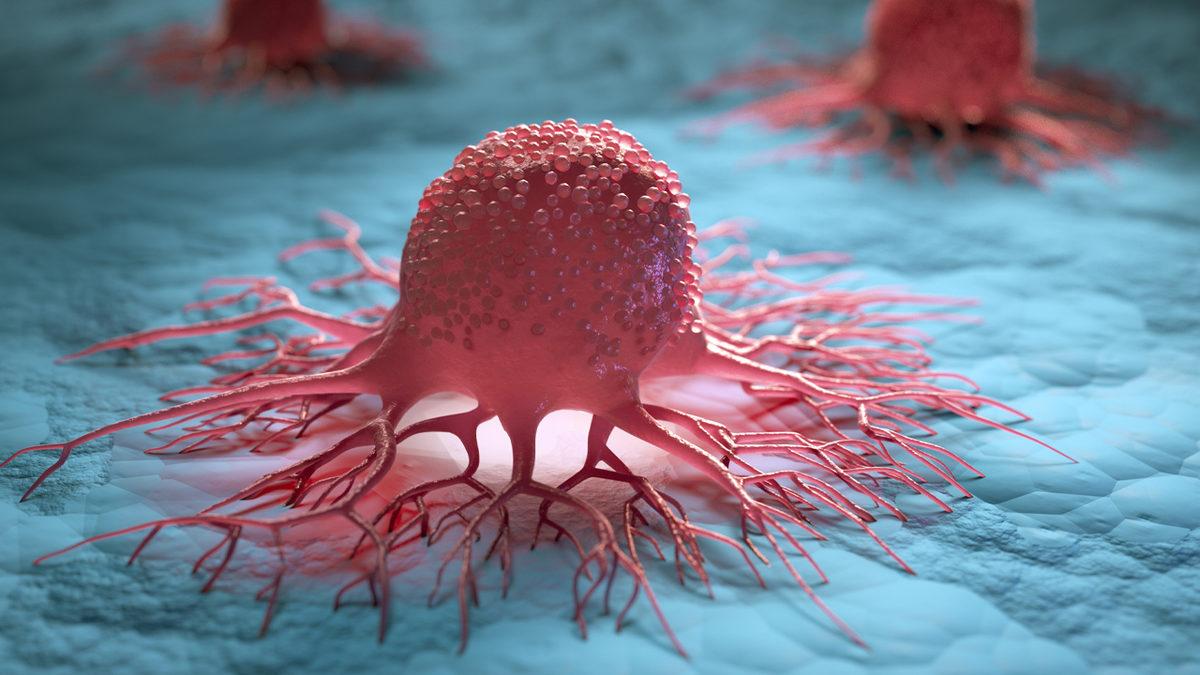 Neden Sürekli “Kansere Çare Bulundu” Haberleri Görüyoruz ve Gerçekten Önemli Bir Gelişme Olduğunda Bunu Nasıl Anlayacağız?