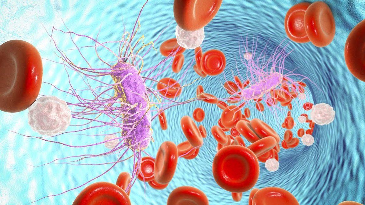 Halk Arasında Kan Zehirlenmesi Olarak da Bilinen Sepsis Nedir, Neden Olur, Nasıl Tedavi Edilir?