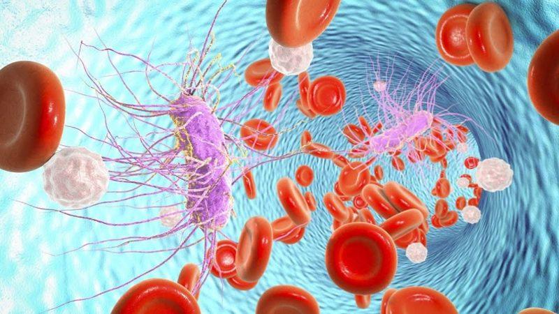 Halk Arasında Kan Zehirlenmesi Olarak da Bilinen Sepsis Nedir, Neden Olur, Nasıl Tedavi Edilir?