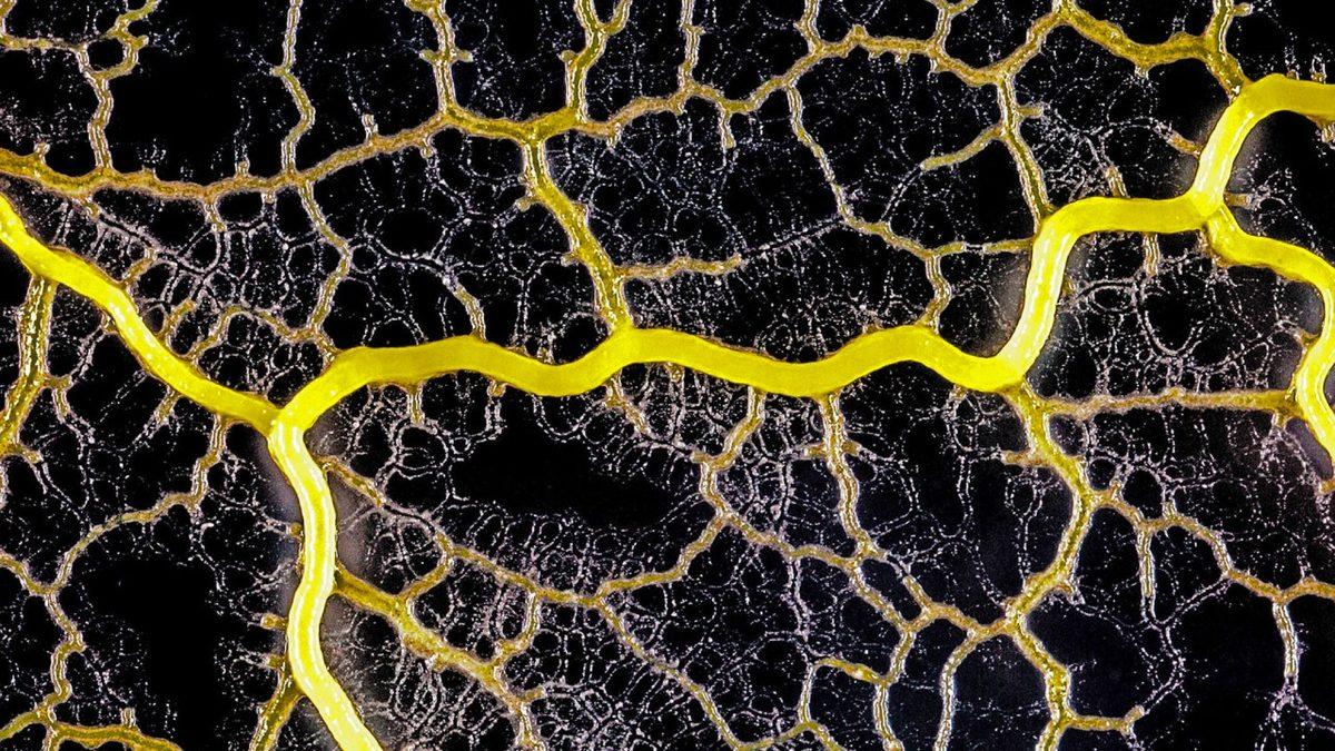 Beyni Bile Olmayan Bu Canlının Sahip Olduğu Yetenekleri Duyunca Şimdiye Kadar Nasıl Haberim Olmamış Diyeceksiniz!