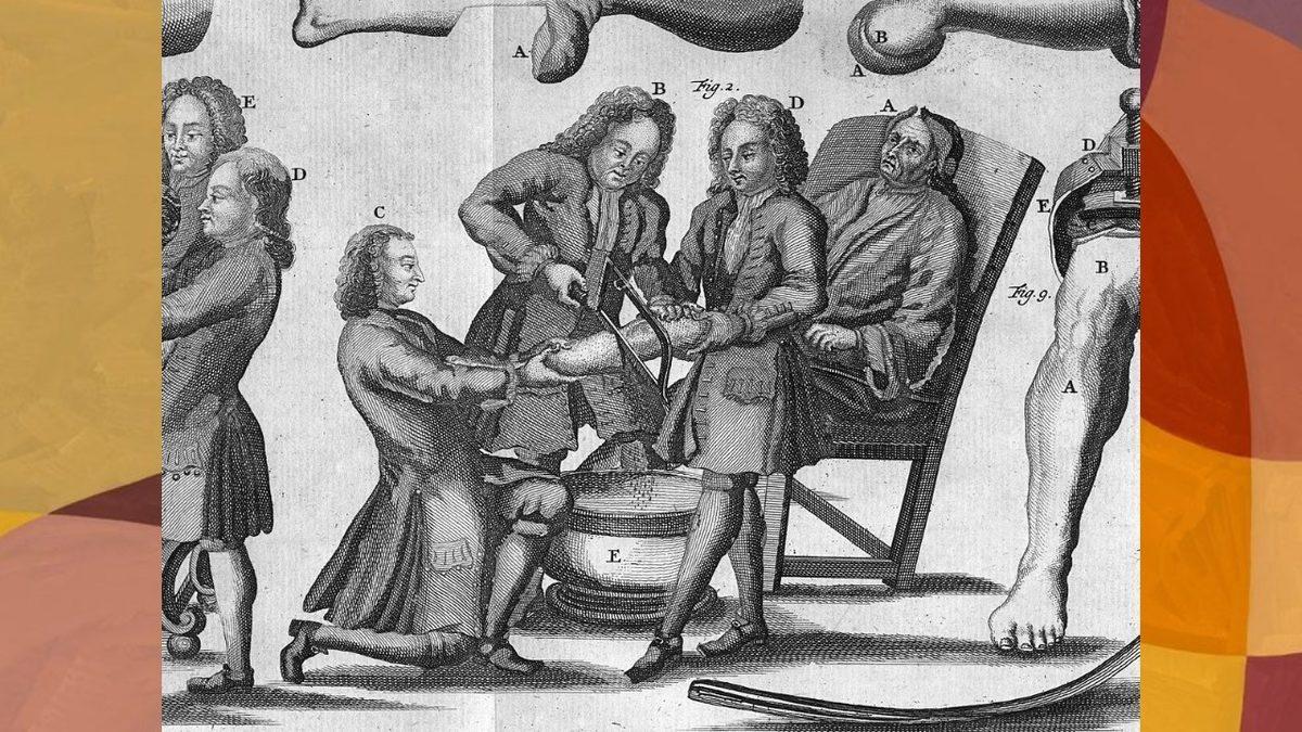 Kan Kaybını Önlemek İçin Eskiden Hekimlerin Uyguladığı Akla Hayale Gelmeyecek Yöntemler