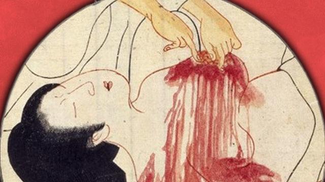 Kan Kaybını Önlemek İçin Eskiden Hekimlerin Uyguladığı Akla Hayale Gelmeyecek Yöntemler