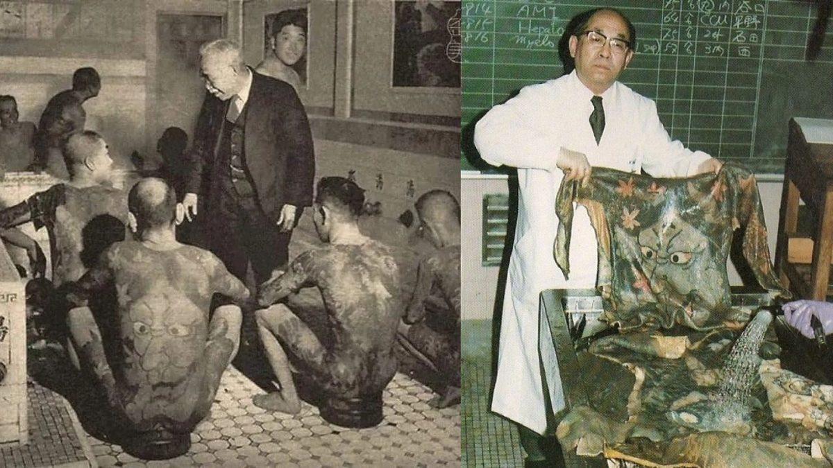 Tuhaflıklarla Dolu Bir Hikâye: Ölü İnsanların Dövmeli Derilerini Koleksiyon Yapan Takıntılı Doktor