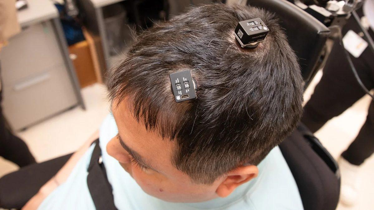 Beyne Yerleştirilen Yapay Zekâ Destekli Çip, Felçli Bir Adamın Kolunu Tekrar Hareket Ettirmesini Sağladı