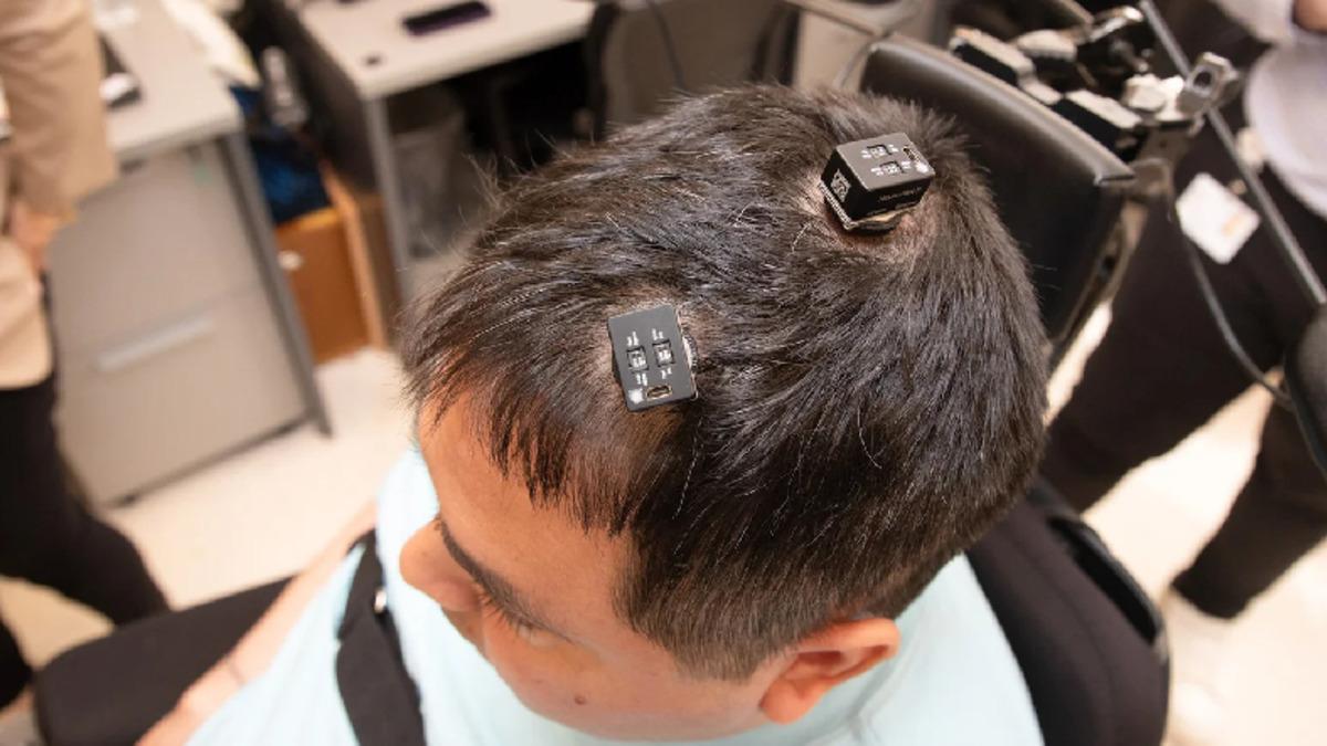 Beyne Yerleştirilen Yapay Zekâ Destekli Çip, Felçli Bir Adamın Kolunu Tekrar Hareket Ettirmesini Sağladı