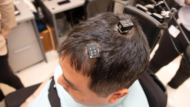 Beyne Yerleştirilen Yapay Zekâ Destekli Çip, Felçli Bir Adamın Kolunu Tekrar Hareket Ettirmesini Sağladı