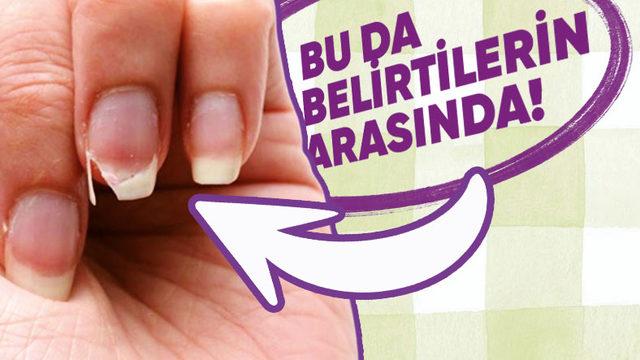 Pek Çok Hastalığın Temel Nedeni Olan ’Demir Eksikliğine’ Ne İyi Gelir, Belirtileri Nelerdir?