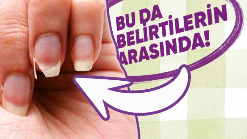 Pek Çok Hastalığın Temel Nedeni Olan ’Demir Eksikliğine’ Ne İyi Gelir, Belirtileri Nelerdir?