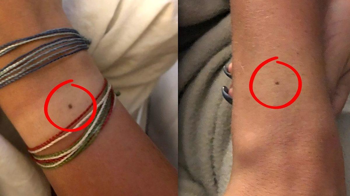 Hemen O Noktaya Bakmak İsteyeceksiniz: Nasıl Oluyor da Çoğumuzun Tam Aynı Yerinde Bu Küçük Benlerden Çıkabiliyor?