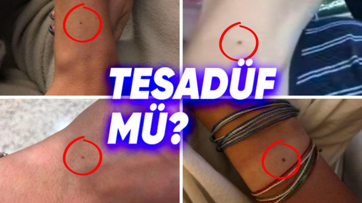 Hemen O Noktaya Bakmak İsteyeceksiniz: Nasıl Oluyor da Çoğumuzun Tam Aynı Yerinde Bu Küçük Benlerden Çıkabiliyor?