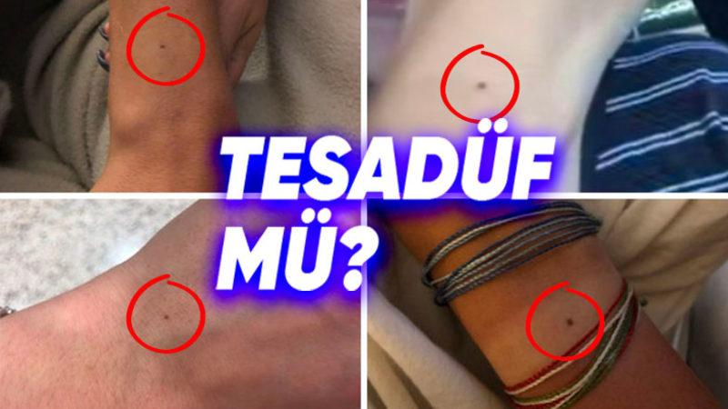 Hemen O Noktaya Bakmak İsteyeceksiniz: Nasıl Oluyor da Çoğumuzun Tam Aynı Yerinde Bu Küçük Benlerden Çıkabiliyor?