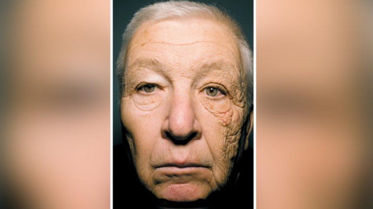 Çabuk, Yaz Bitmeden: Güneş Kremi mi Daha Zararlı, Yoksa Güneş Işınları mı?