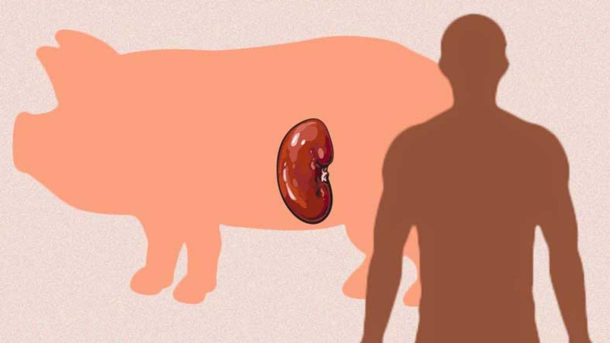 Domuzdan İnsana Böbrek Naklinde Tarihi Bir İlke İmza Atıldı