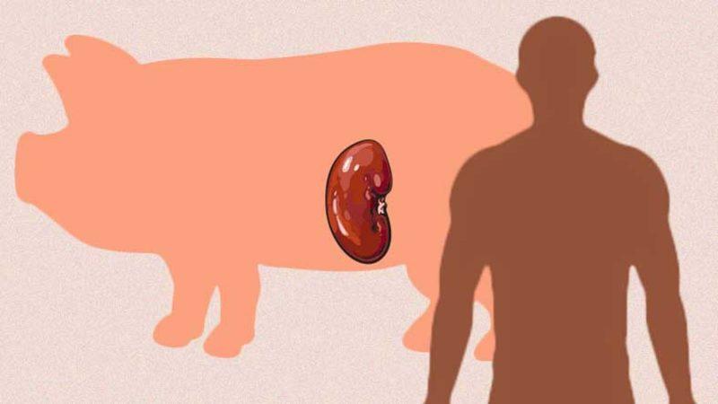 Domuzdan İnsana Böbrek Naklinde Tarihi Bir İlke İmza Atıldı