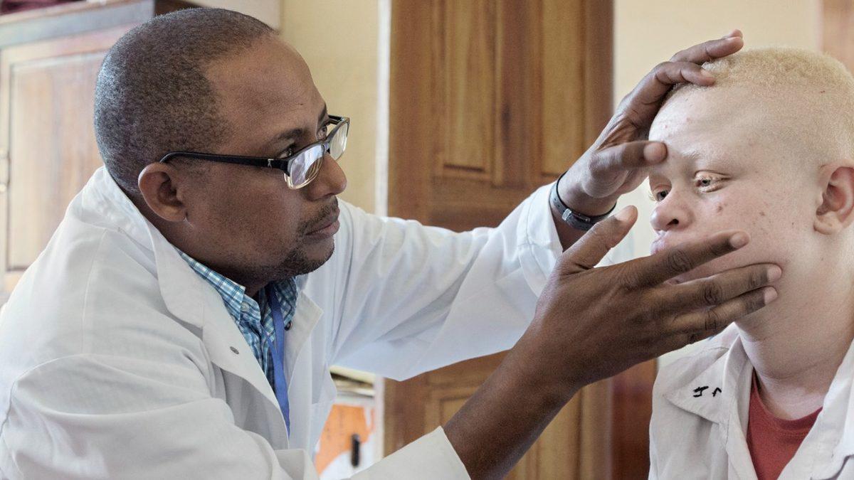 Saç ve Ciltte Renk Farklılığına Neden Olan Albino Hastalığı Nedir, Neden Olur, Kalıtsal mıdır?