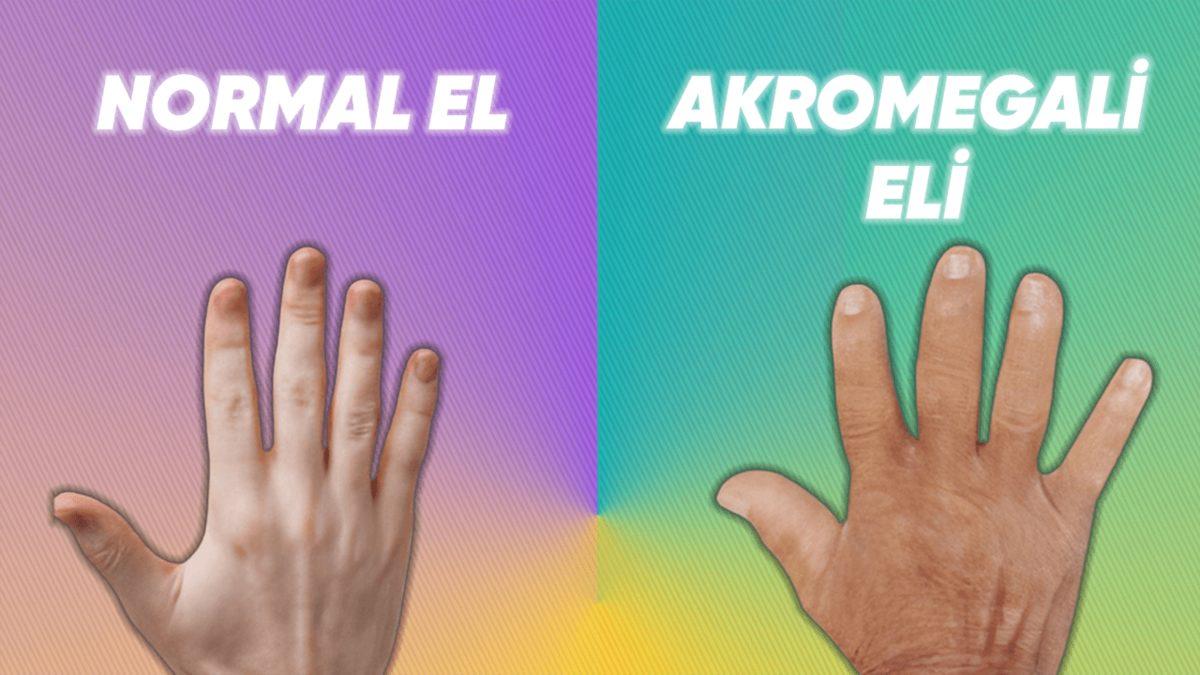 Görünüşü Nedeniyle Çocukları İçin Sirkte Çalışmak Zorunda Kalan Mary Ann Bevan’ın Trajik Hayatı