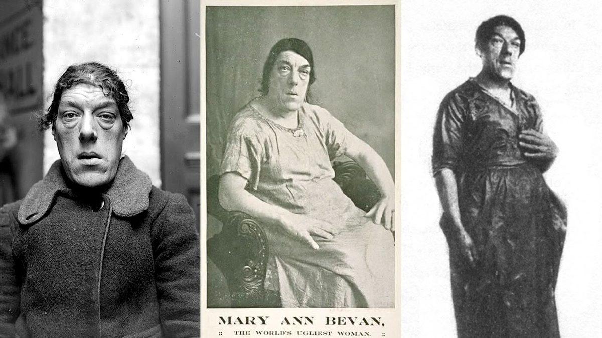 Görünüşü Nedeniyle Çocukları İçin Sirkte Çalışmak Zorunda Kalan Mary Ann Bevan’ın Trajik Hayatı