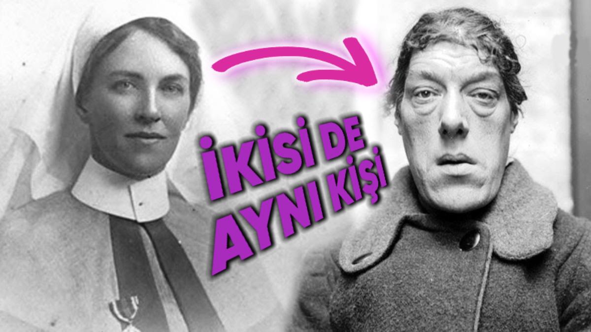 Görünüşü Nedeniyle Çocukları İçin Sirkte Çalışmak Zorunda Kalan Mary Ann Bevan’ın Trajik Hayatı