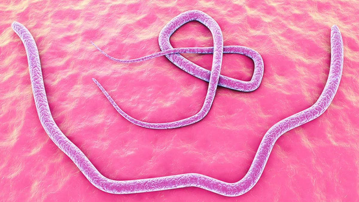 Bir Kadının Beyninden 8 cm’lik Canlı Solucan Çıkarıldı: Peki Bu Nasıl Mümkün Oldu?