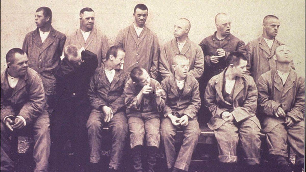 Vipeholm Deneyi: Diş Çürüklerinin Sebebini Keşfetmek Keşke Bu Kadar Acımasızca Olmasaydı!