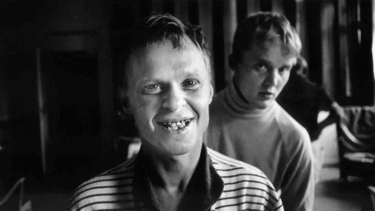 Vipeholm Deneyi: Diş Çürüklerinin Sebebini Keşfetmek Keşke Bu Kadar Acımasızca Olmasaydı!