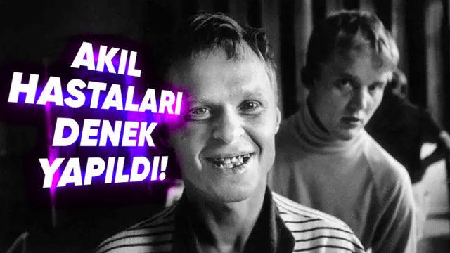 Vipeholm Deneyi: Diş Çürüklerinin Sebebini Keşfetmek Keşke Bu Kadar Acımasızca Olmasaydı!