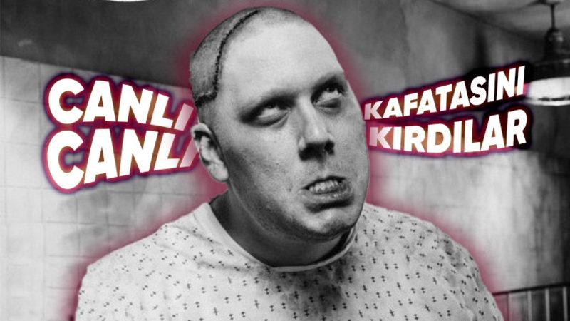 Tıp Tarihinde Milyonlarca İnsanın Akılalmaz Yalanlar ve Yöntemlerle Olumsuz Etkilendiği Büyük Yanlışlar