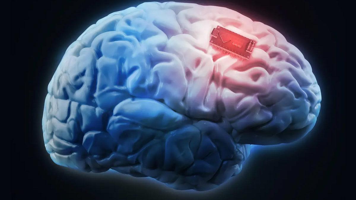 20 Yıldır Konuşamayan Felçli Bir Kadın, Yapay Zekâ Sayesinde Yeniden 