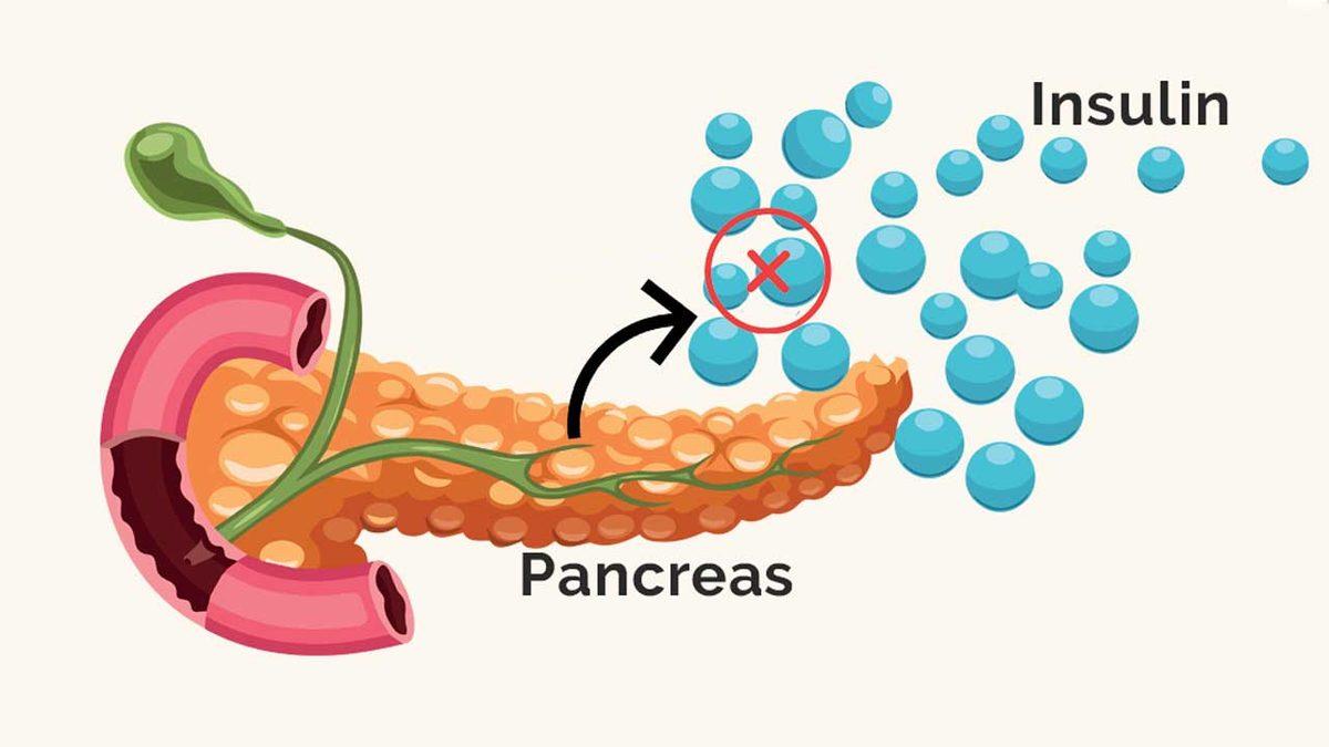 Steve Jobs, Kanseri Yenmek İçin Modern Tıp Yerine Alternatif Tıptan Medet Umarak Pisi Pisine mi Öldü?