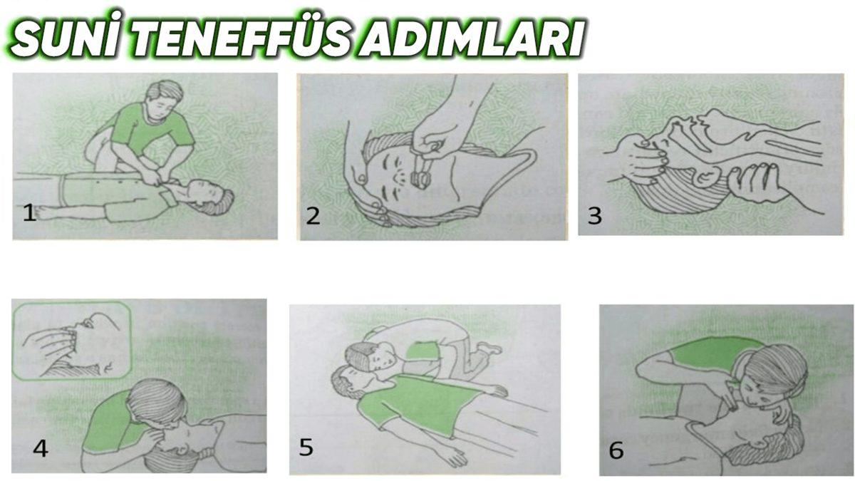 Nefes Verirken Karbondioksit Salıyorsak Nasıl Oluyor da Suni Teneffüs Yaparken Hayat Kurtarabiliyoruz?