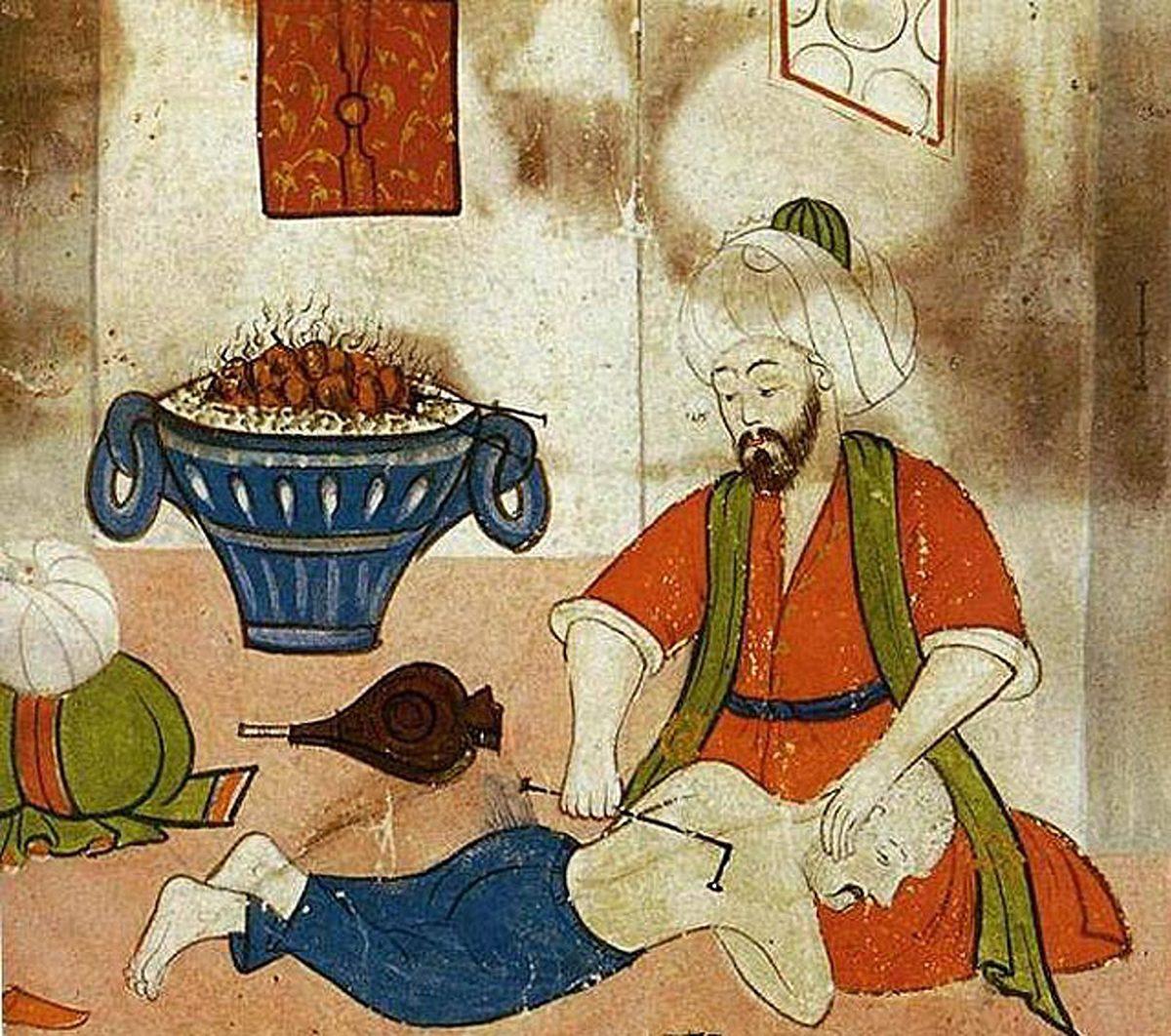 Osmanlı’da Suçluya Ölmek İçin Adeta Dua Ettiren Çeşitli İşkence Yöntemleri