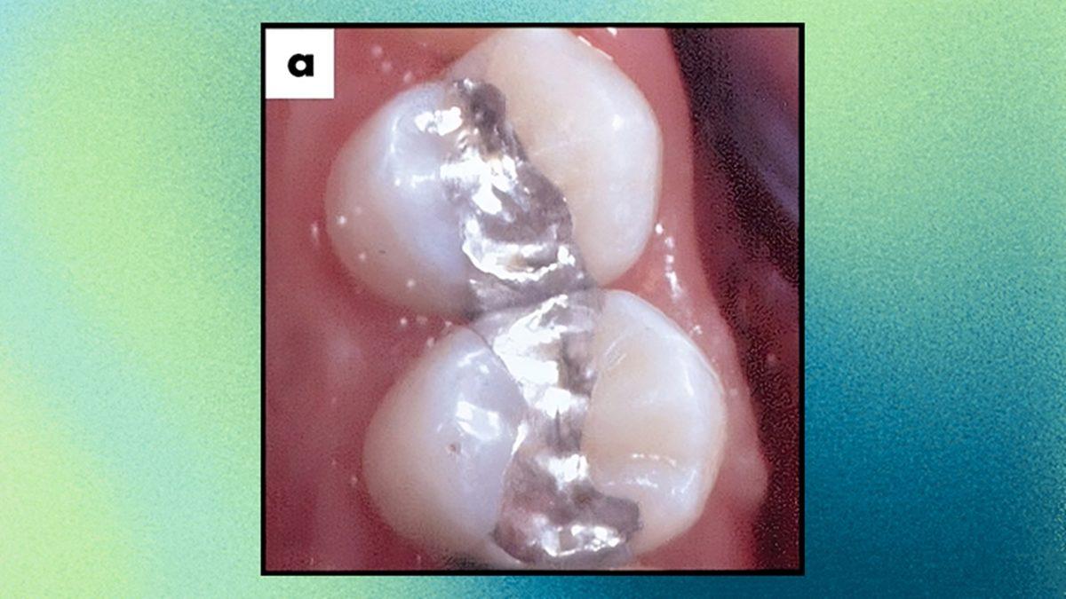 Bazı Metalleri Paramparça Eden Bu Element, Nasıl Oluyor da Elimize Değdiğinde Hiç Zarar Vermiyor?