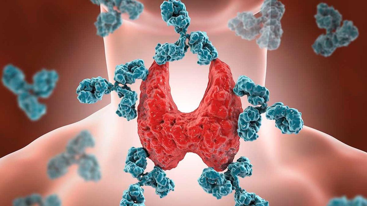 Metabolizma Hızımız İçin Çok Önemli Olan ‘TSH’ Nedir, Yüksekliği Ne Anlama Gelir?