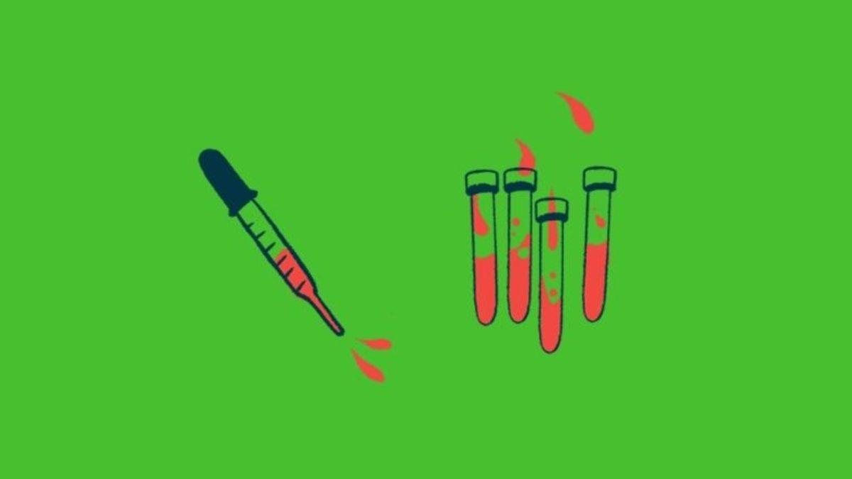 Alzheimer Tedavisinde Umut Verici Gelişme: Hastalığı Teşhis Edebilecek Kan Testi Kitleri Geliştirildi