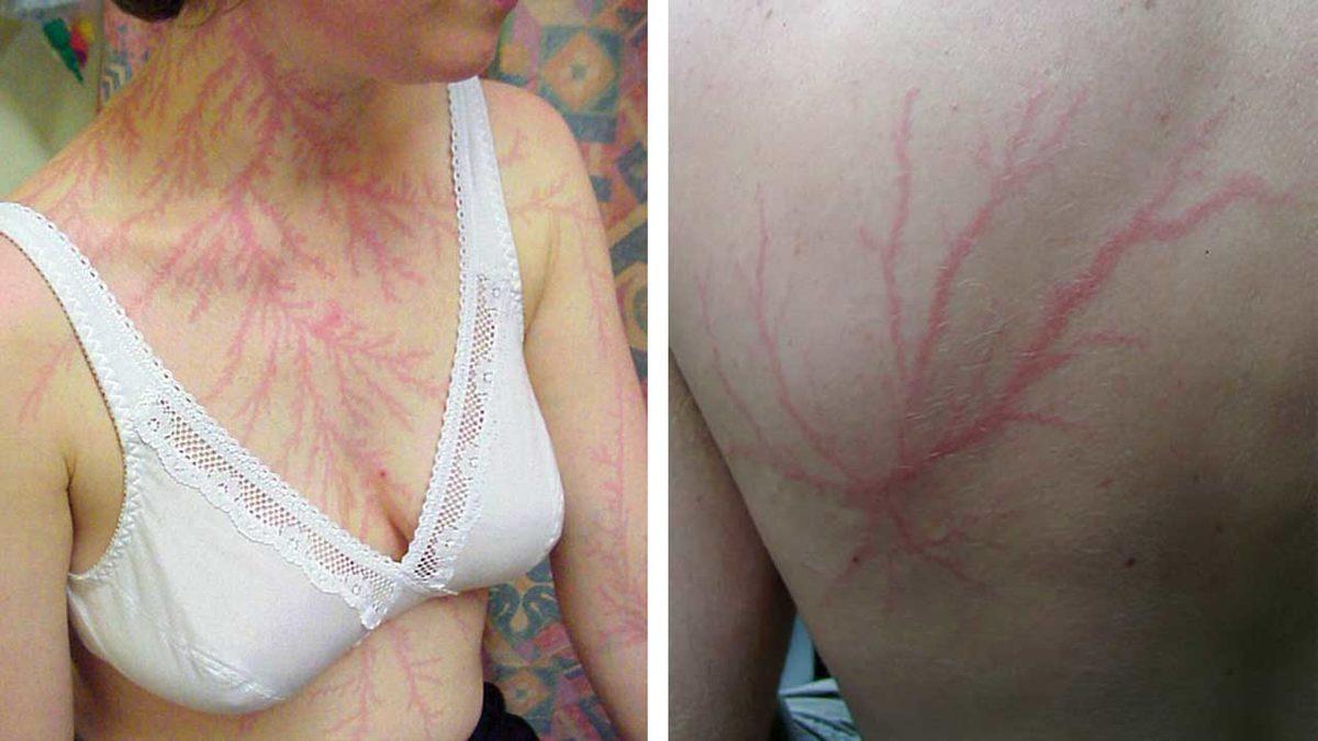 Dışarıdayken Saçlarınız Bir Anda Bu Şekilde Elektriklenirse Oradan Kaçmanızda Fayda Var! Peki Neden?