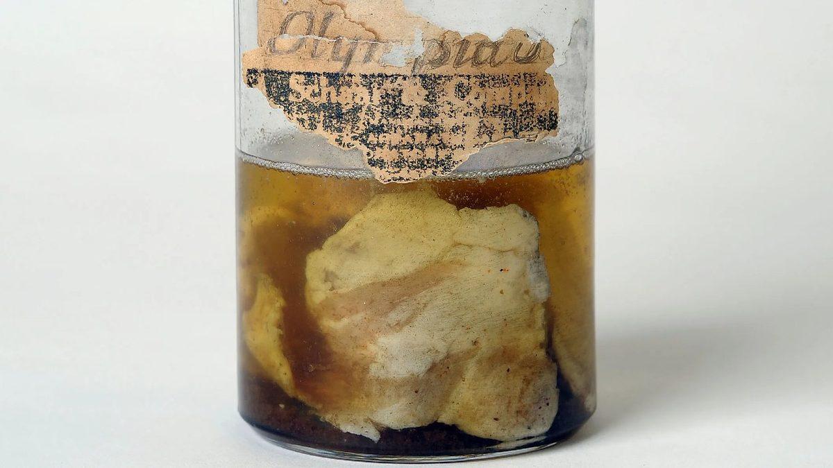 Gökten Aniden Yüzlerce Et Parçasının Yağdığı Gizemli Olay: Kentucky Et Yağmuru