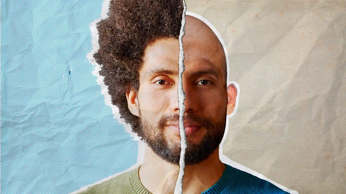 Şimdiye Kadar Neredeyse Hiç Kel Kadın Görmemenizin Asıl Sebebi Ne? İşte İçimizdeki O Kilit Faktör...