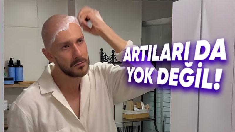 Şimdiye Kadar Neredeyse Hiç Kel Kadın Görmemenizin Asıl Sebebi Ne? İşte İçimizdeki O Kilit Faktör...